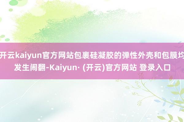 开云kaiyun官方网站包裹硅凝胶的弹性外壳和包膜均发生闹翻-Kaiyun· (开云)官方网站 登录入口